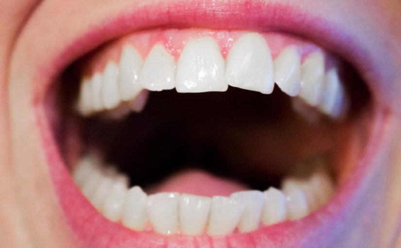 Obecna technika stosowana w salonach stomatologii estetycznej być może sprawić, że odbierzemy śliczny uśmiech.
